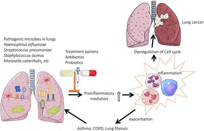 Role of Lung Microbiome in Innate Immune Response Associated With Chronic Lung Diseases